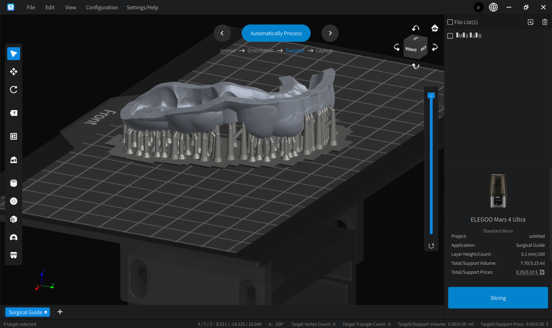 歯科専用chitubox スライサー「chitubox dental」を紹介 - DDI